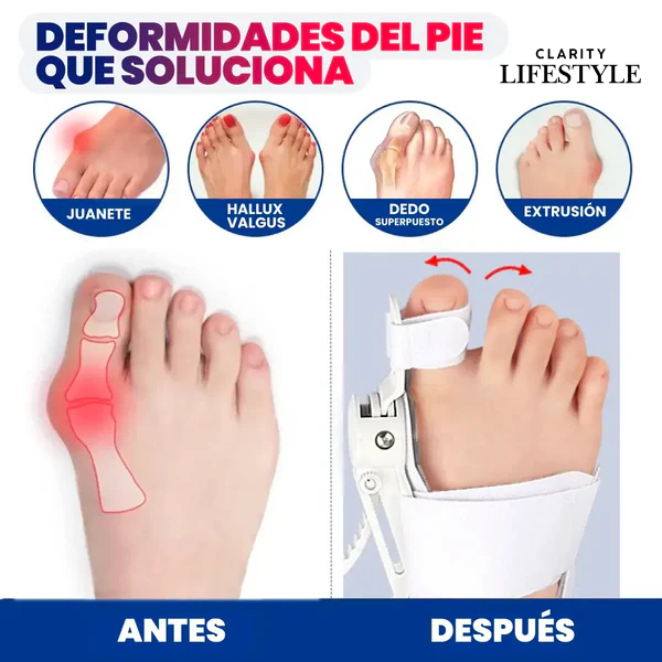 Corrector De Juanetes JuanetFLex®
